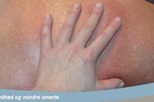 Massage Hjallerup – Hjallerup